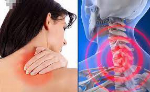 Trị liệu cổ vai gáy